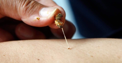 Picadas de abelhas podem levar à morte